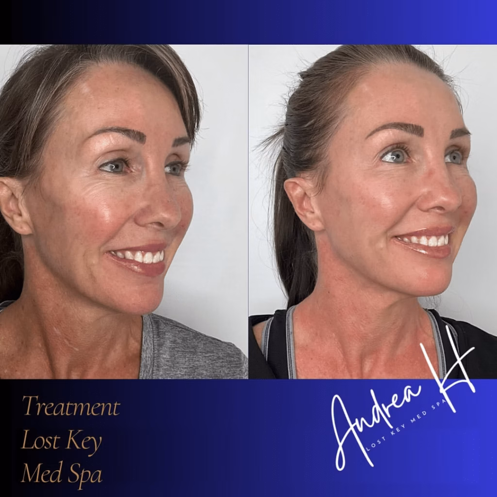 37802a72fd8ec55d0c1556fd27a8dbd180a8950c