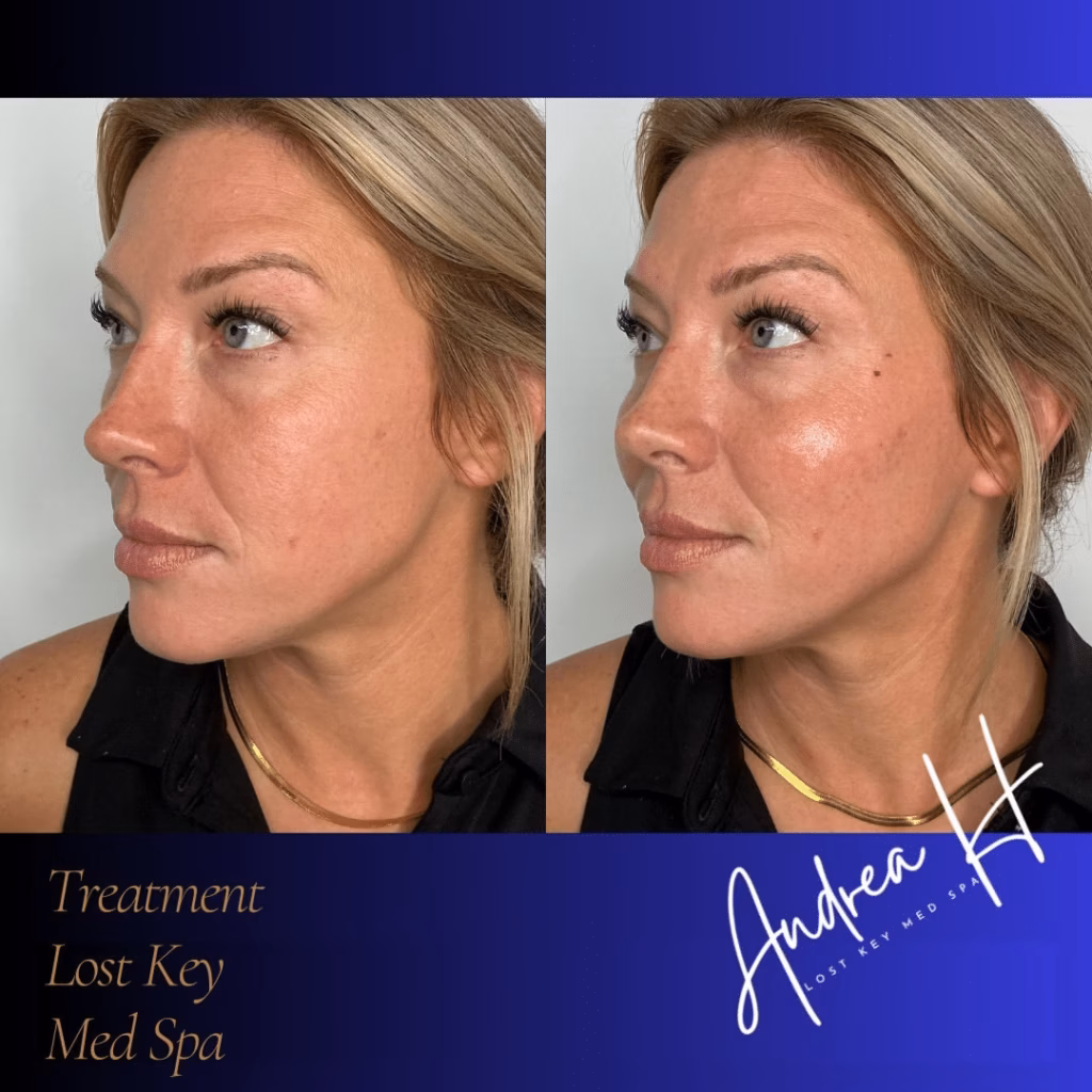 d064a5d1ab0311d1beb6e43be6223a8fd326f2c8