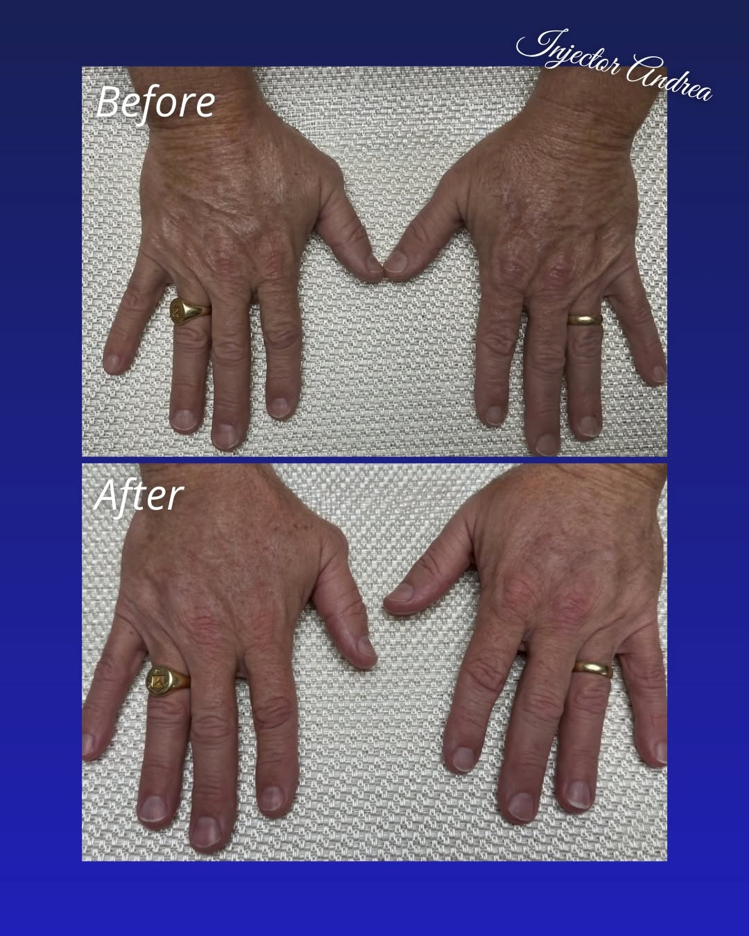 Before and after result