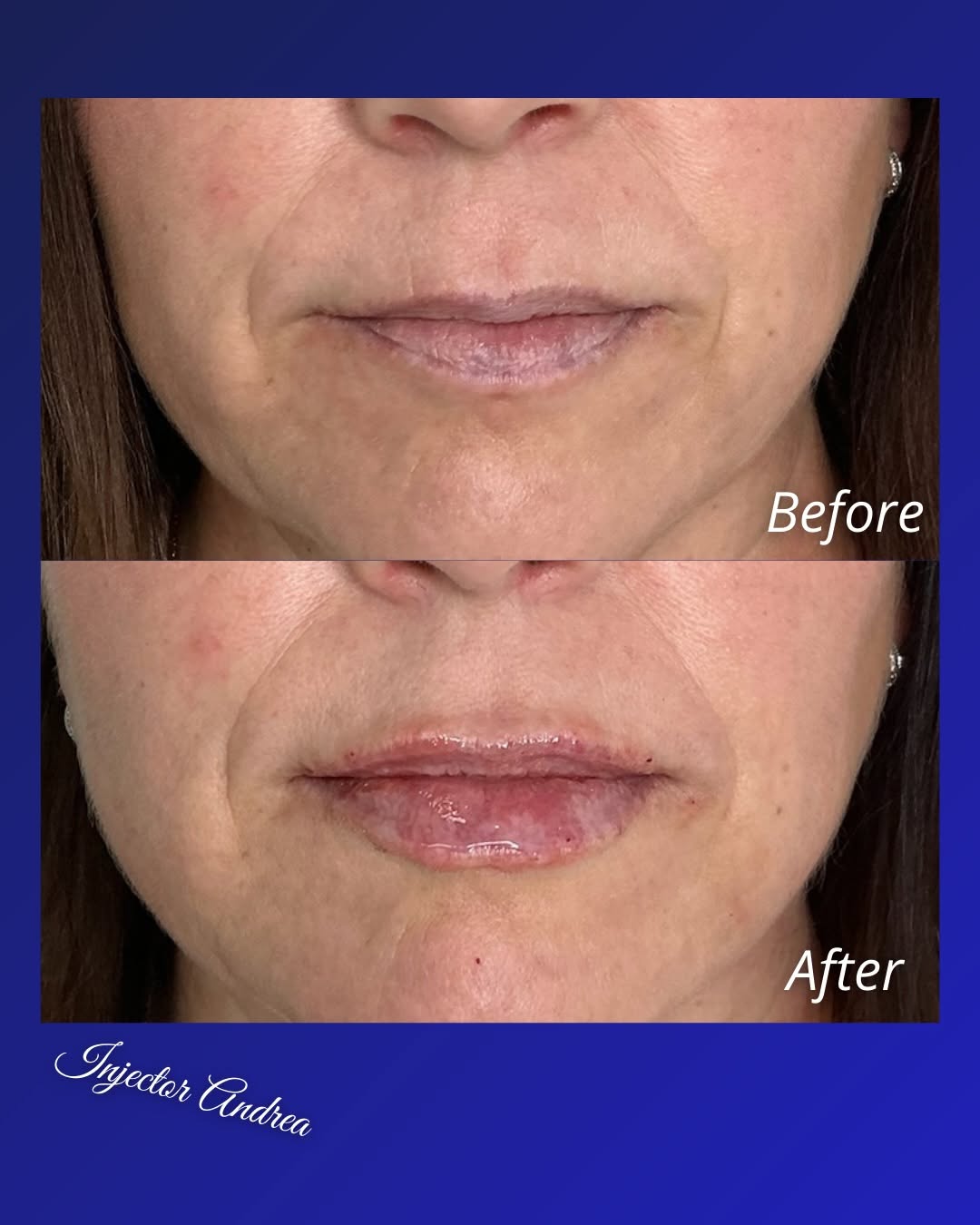 Before and after result