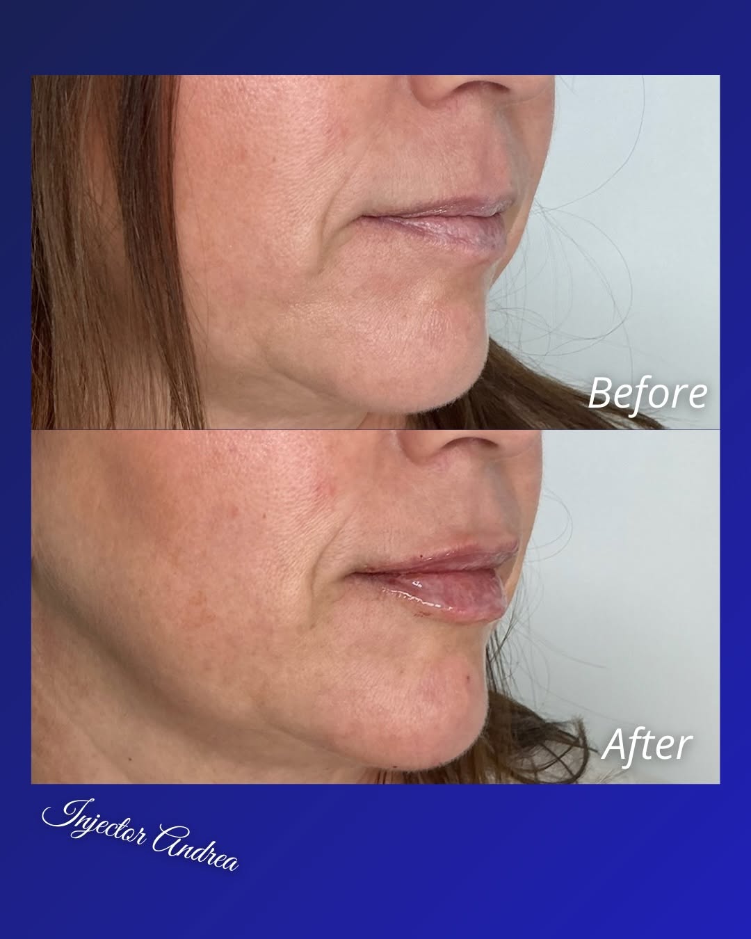 Before and after result