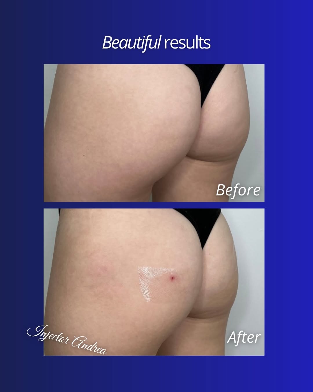 Before and after result