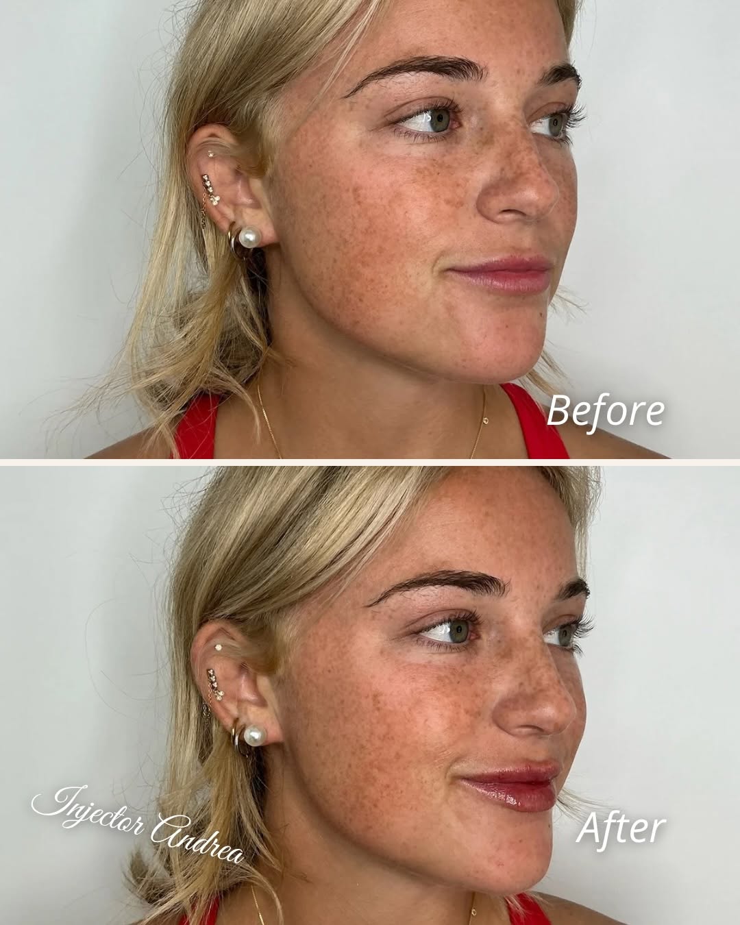 Before and after result