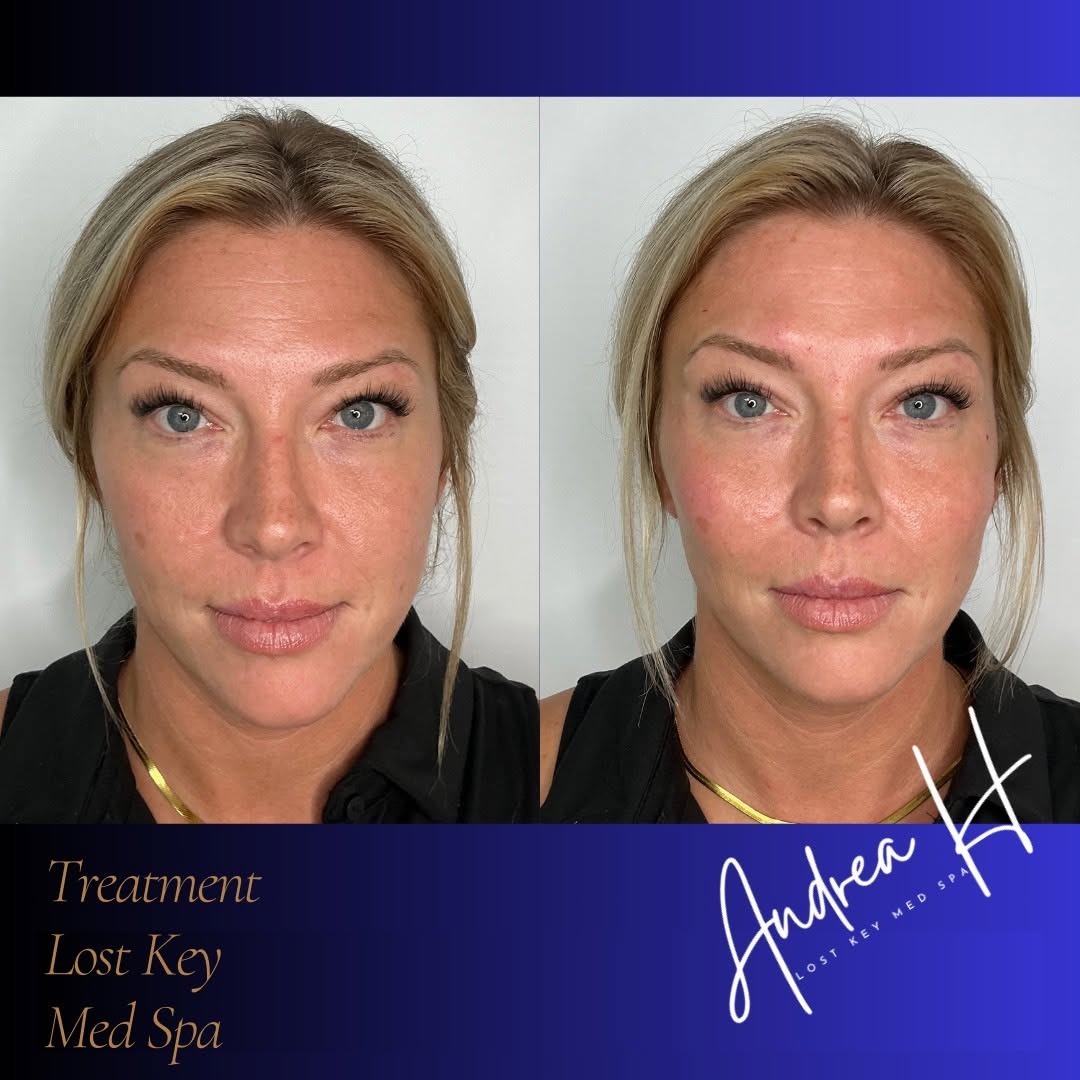 Before and after result