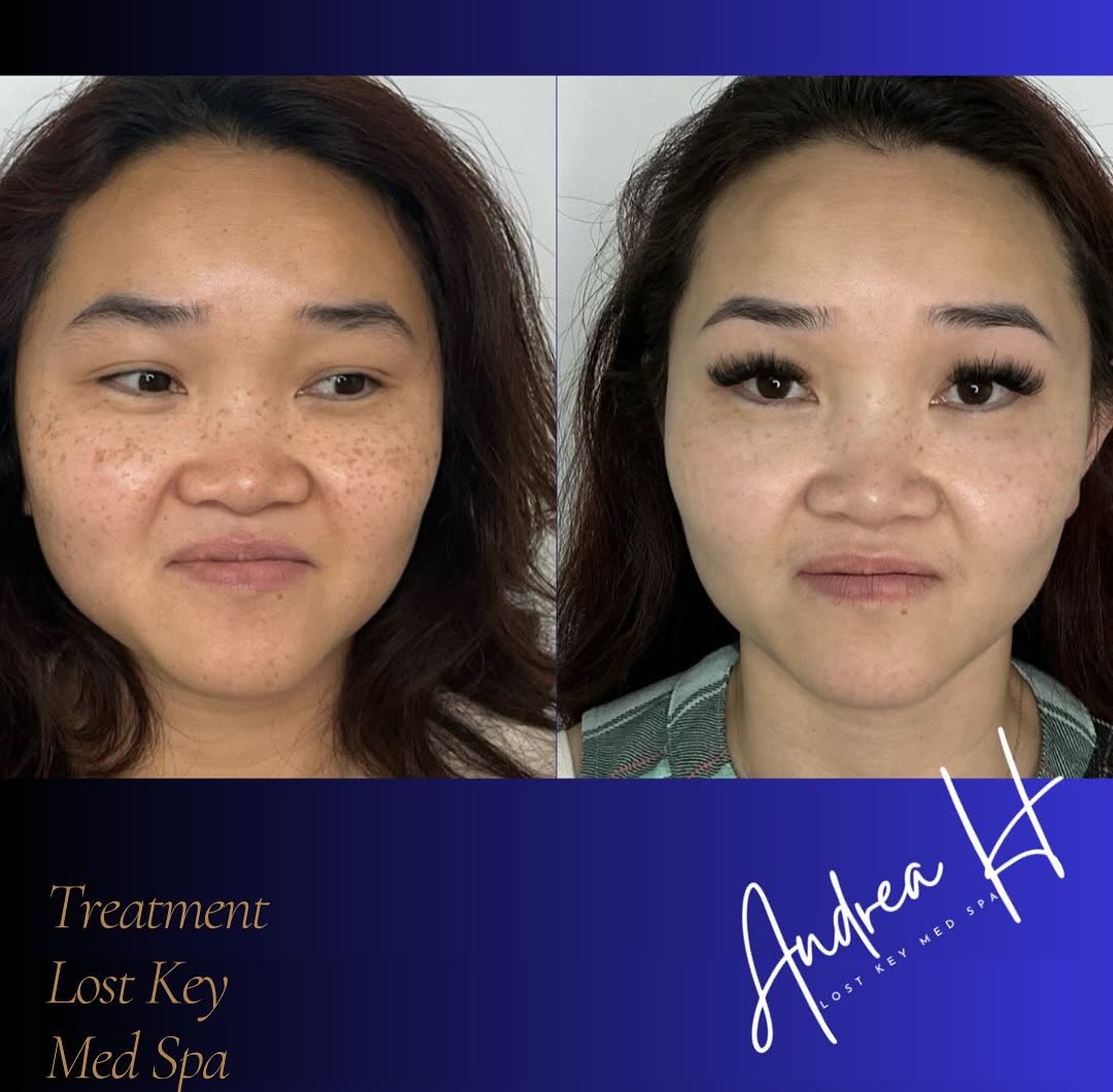 Before and after result