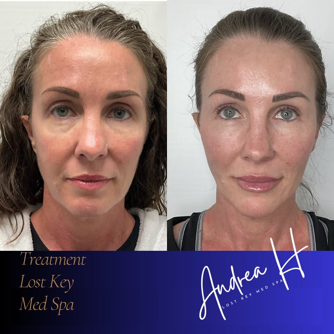 Before and after result