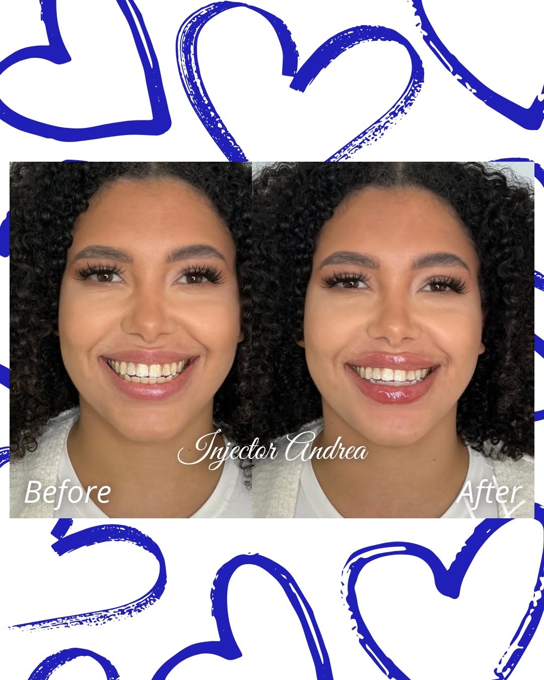Before and after result