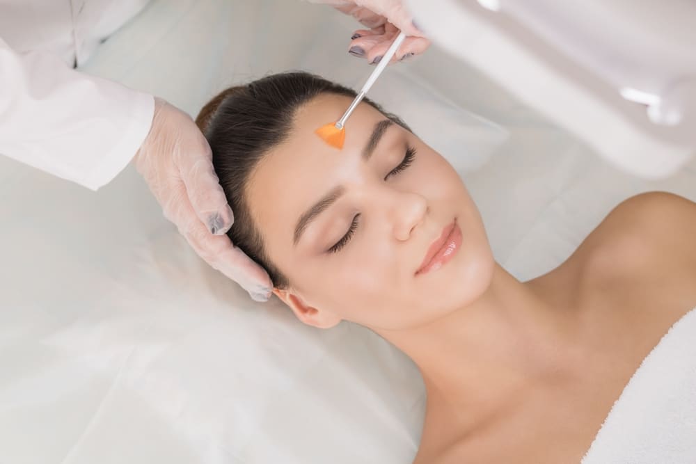 Chemical peels Pensacola FL